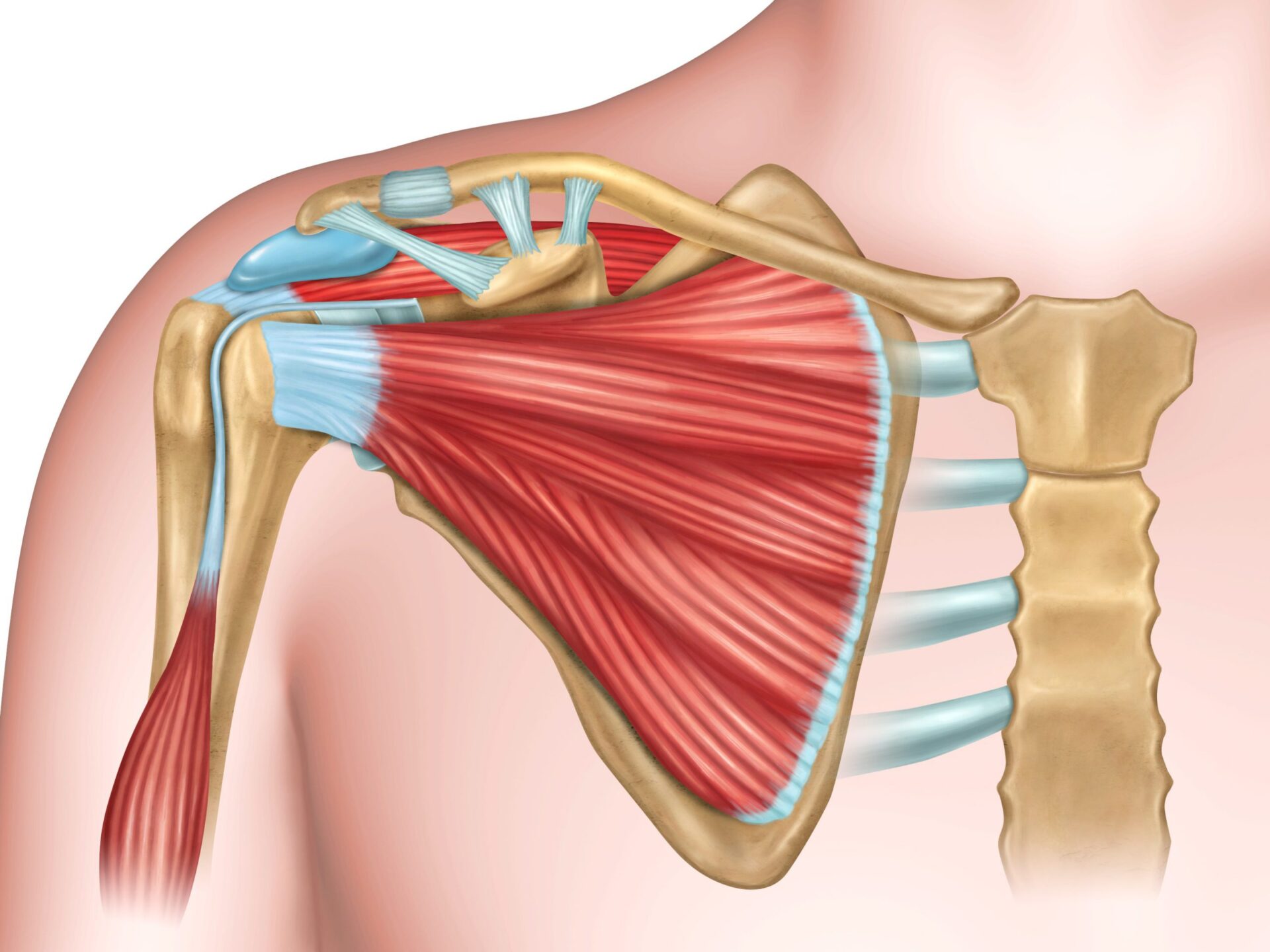 Lesi n De Tendinitis Del Manguito Rotador Lesi n De Tendinitis Del Manguito Rotador